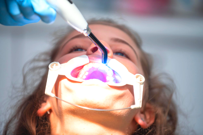 أنواع وتقنيات تجميل الأسنان